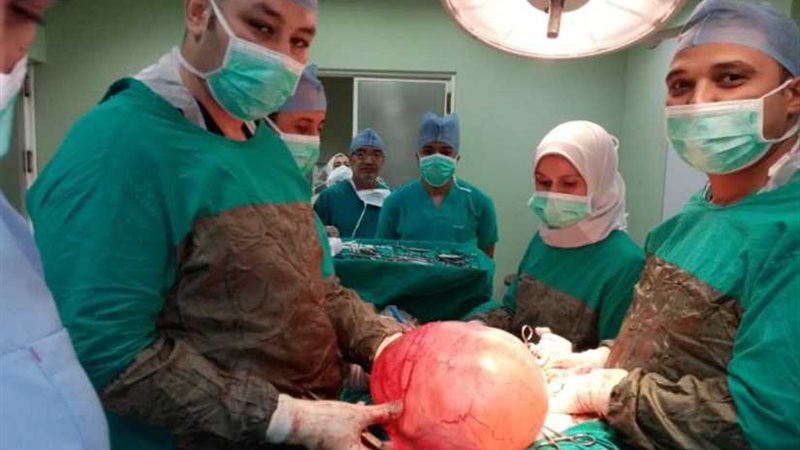 يزن 25 كيلو.. استئصال