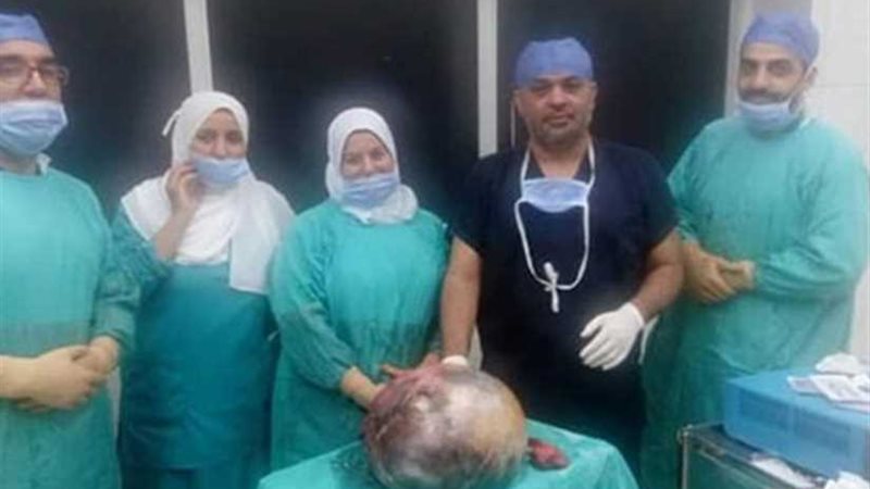 استئصال ورم يزن 6