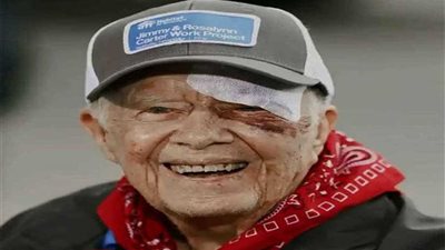 نقل الرئيس الأمريكي الأسبق كارتر للمستشفى بسبب نزيف دماغي