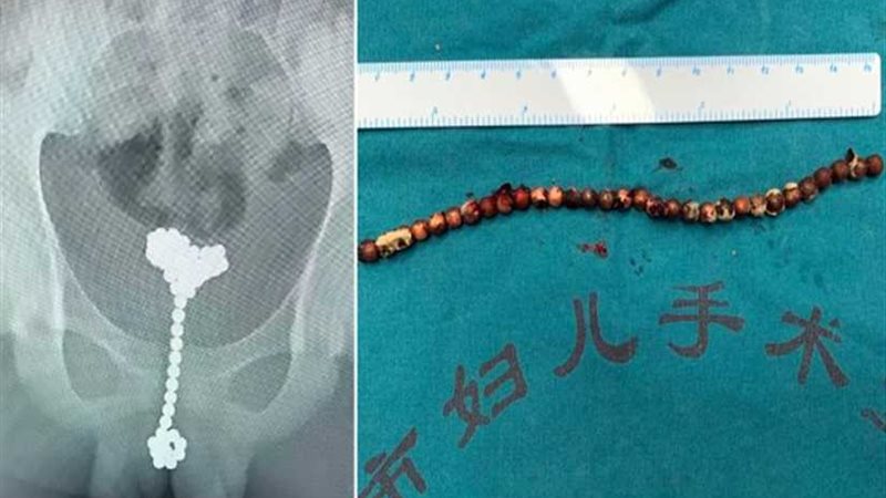 العثور على 31 بلية