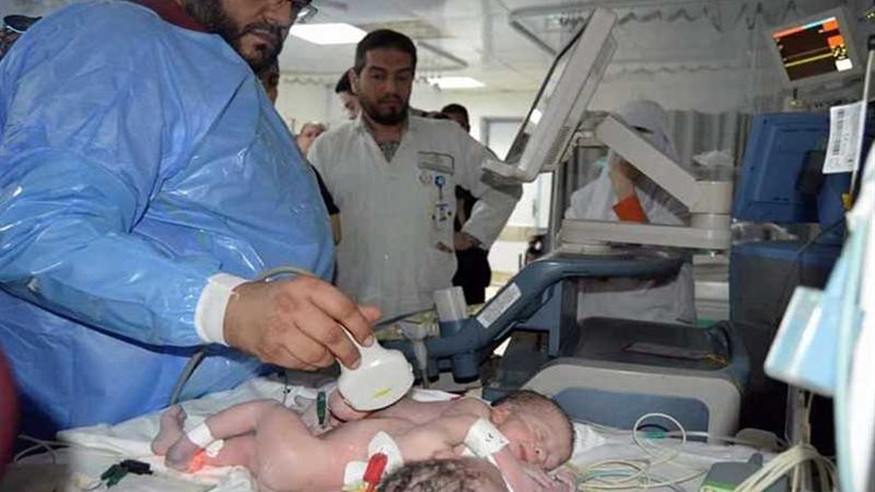 لأول مرة.. ولادة