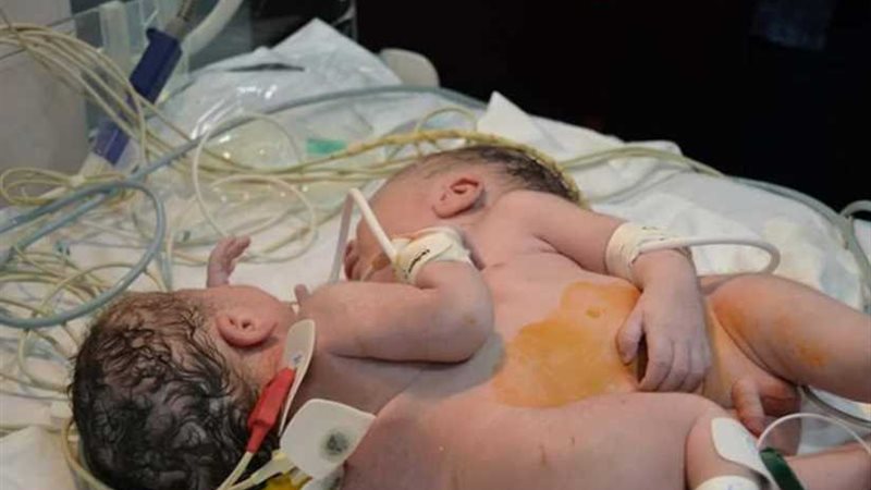 جامعة المنصورة تتكفل