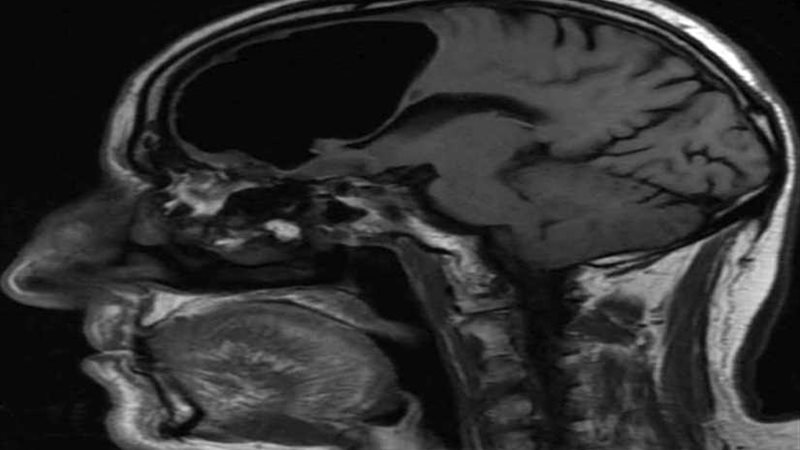 معجزة.. رجل عاش 84