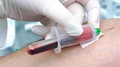 فحص 408 آلاف مواطن خلال مبادرة الرئيس للقضاء على فيروس 