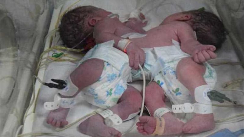 وفاة أحد الطفلين