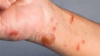 إصابة سيدتين في حريق جنوب بني سويف