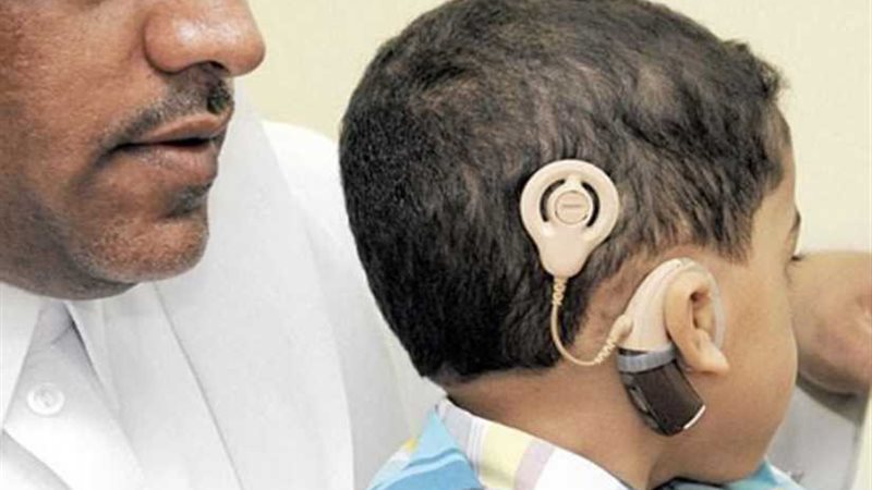 أجهزة تعويضية وأطراف