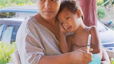 ارتفاع حصيلة الوفيات بسبب الحصبة في 