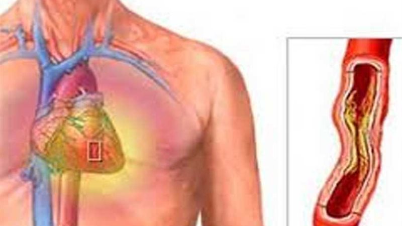 تعرف على أفضل طريقة