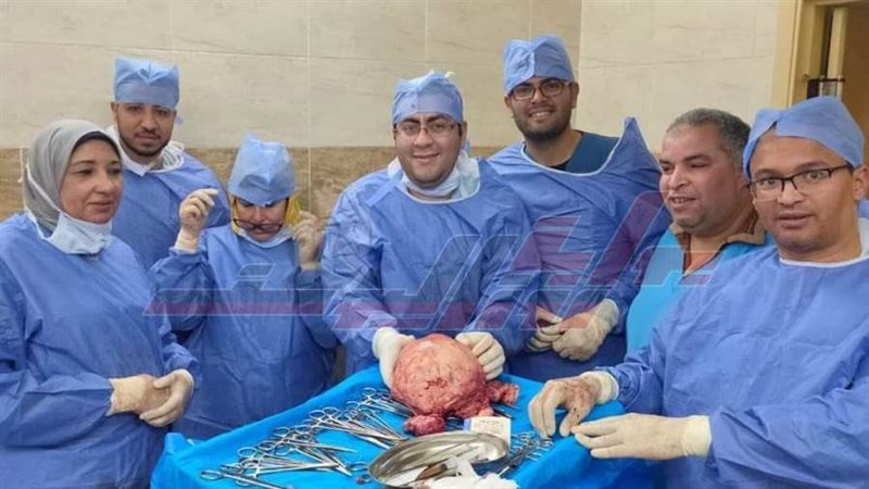 استئصال ورم من رحم