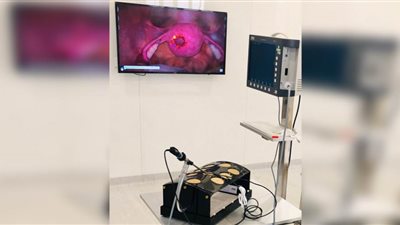 مستشفي أمراض النساء بقصر العيني يفتتح مختبرا يضم أول أجهزة محاكاة ثلاثية الأبعاد في مصر