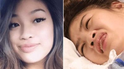 دخول فتاة في غيبوبة منذ 5 أشهر بسبب جرعة بنج زائدة