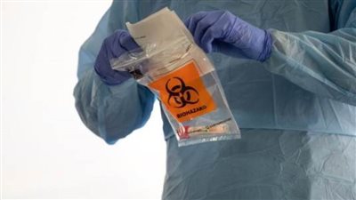 اليوم.. أول تجربة على البشر للقاح علاج فيروس 