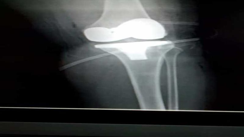 على نفقة الدولة..