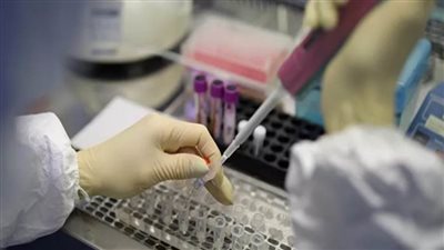 شركة روسية تطور اختبارا جديدا للكشف عن فيروس كورونا