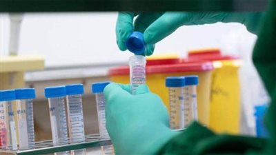  عاجل ..عقار يقضى على فيروس كورونا خلال 48ساعة 