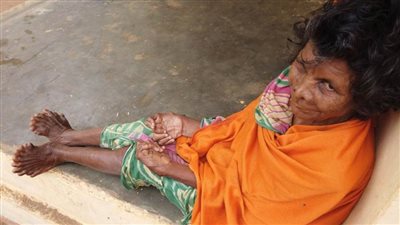 هندية تحقق رقماً قياسياً وتدخل جينيس بــ31 إصبعا