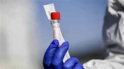 كشف علمي ينعش الآمال في التغلب على 