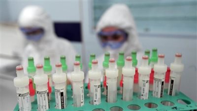 الوكالة الروسية للطب والبيولوجيا تثبت فعالية عقار الملاريا ضد كورونا