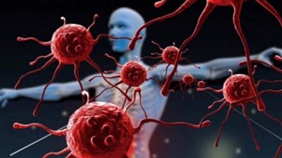 4 علامات قد ترتبط بالسرطان لا ينبغي تجاهلها!