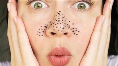 ماسك طبيعي للتخلص من الرؤوس السوداء