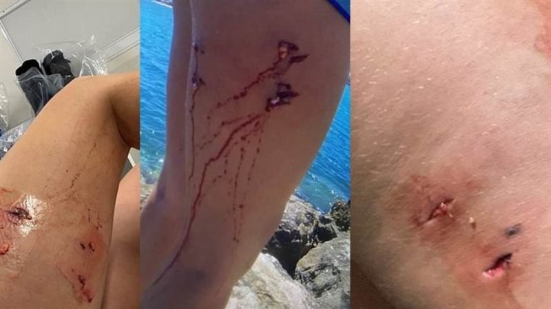 سبع البحر أحدث جروحا