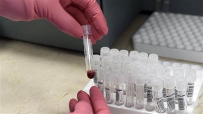 بريطانيا: احتمال الحصول على لقاح ضد كورونا في 2021 ضئيل للغاية