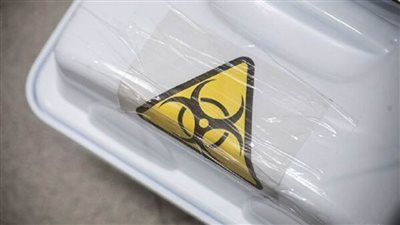 خبير: معظم الأمراض المعدية للإنسان سببها الحيوانات