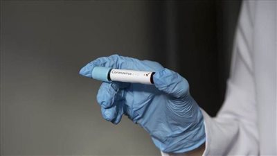 روسيا: ارتفاع إجمالي إصابات كورونا إلى أكثر من 74 ألفا