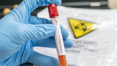 باكستان: ١٢٢٢٧ إصابة بفيروس كورونا و٢٥٦ وفاة