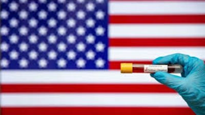 أمريكا.. إصابة مليون و62 ألف ووفاة أكثر من 62 ألف بـ