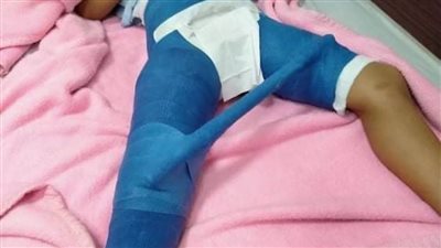 إصابة لاعب شهير وإجراء عملية جراحية بالإسكندرية