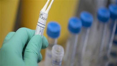 روسيا  تختبر دواء لعلاج 