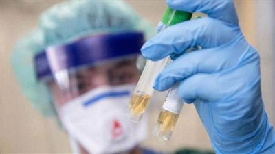 روسيا تعلن إجراء أكثر من 6.9 مليون اختبار للكشف عن فيروس 