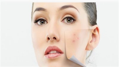 7 علاجات منزلية فعالة لعلاج البقع الداكنة على الجلد