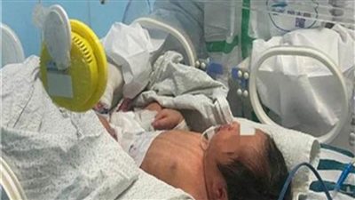 ثالث حالة ولادة لمصابة بكورونا داخل المستشفيات التعليمية