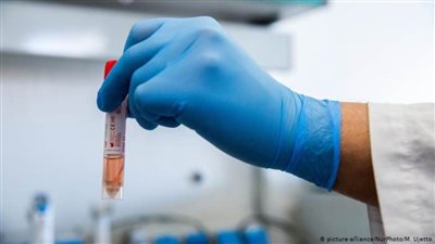 اليابان تحدد موعد الحصول على لقاح ضد كورونا 