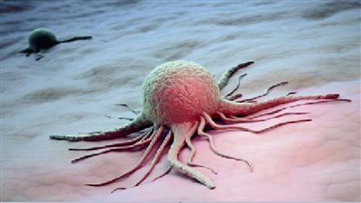 جراح روسي.. مادة نستخدمها في المطبخ وتسبب السرطان!