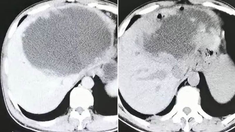 إشاعة كبد المواطن