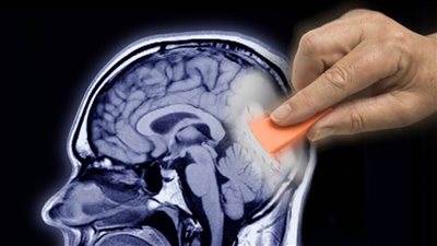 تطوير تقنية تمنع ذكريات الخوف من العودة وتتغلب على اضطراب ما بعد الصدمة