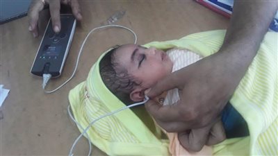 فحص 3910 أطفال بالمنيا ضمن مبادرة السمعيات خلال شهر أغسطس