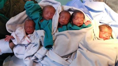 سيدة تضع 5 توائم قيصريا في الشهر الثامن من الحمل 