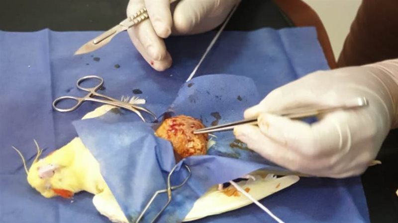 استئصال الورم