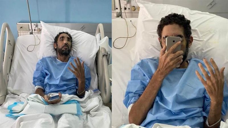 حالة المصري المصاب