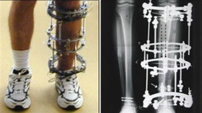 الْيوم.. مستجدات 