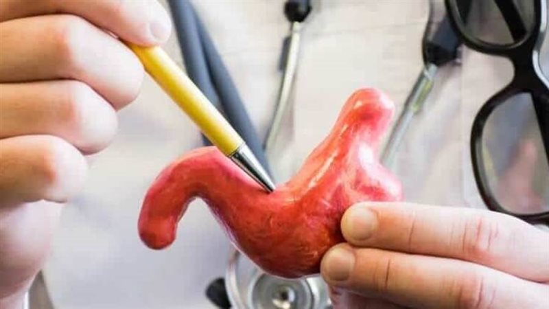 تكميم المعدة