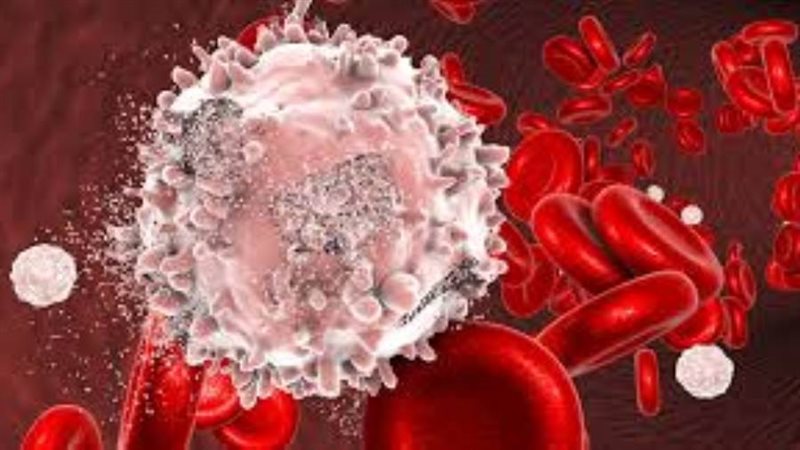 علاج سرطان الدم