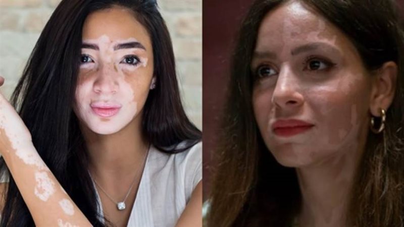 جميلة عوض و لچينة