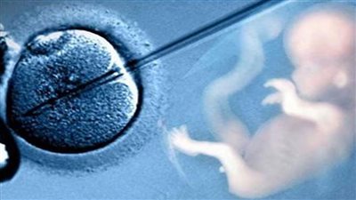 استشاري نساء يكشف فرص نجاح الحقن المجهري