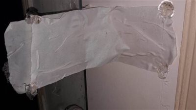 صحة الشرقية: تشميع جناح عمليات لنقص الاشتراطات اللازمة 